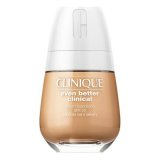 Flydende makeup foundation Even Better Clinique 8010377 (30 ml) SPF20 #1