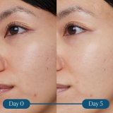 Ansigtsserum Elemis Dynamic Resurfacing 30 ml #4