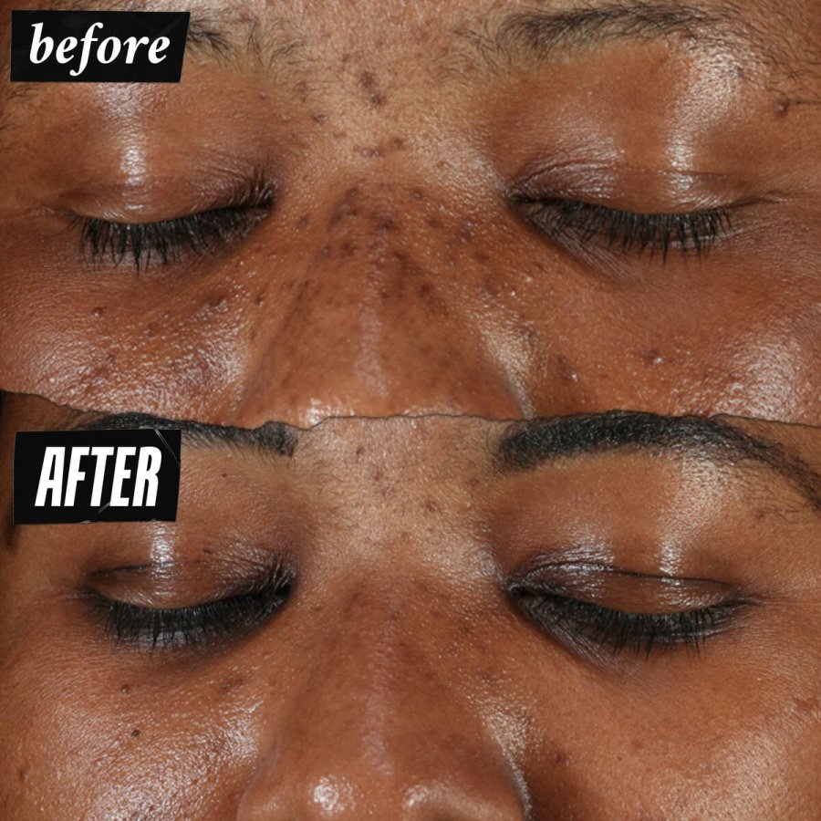 Ansigtscreme Kiehl's DERMATOLOGIST SOLUTIONS #3