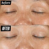 Ansigtscreme Kiehl's DERMATOLOGIST SOLUTIONS #4