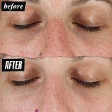 Ansigtscreme Kiehl's DERMATOLOGIST SOLUTIONS #5