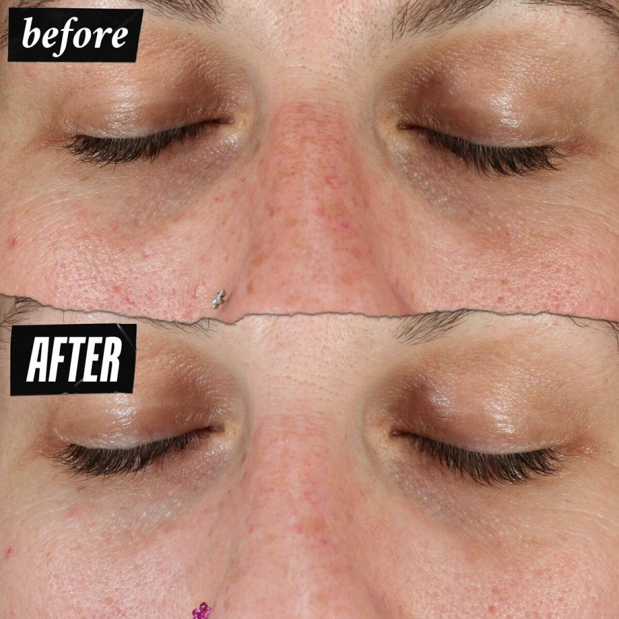 Ansigtscreme Kiehl's DERMATOLOGIST SOLUTIONS #5