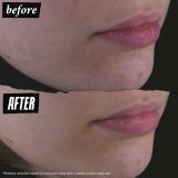 Ansigtsrens i gel-form Kiehl's CALENDULA #6