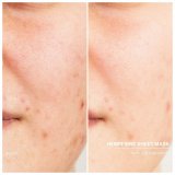 Ansigtsmaske Babor Doc Clean Hemp Fiber 1 enheder #7