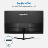 Skrm Medion 30036272 Full HD LCD 22