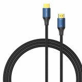 HDMI-kabel Vention ALGLI 3 m Bl #2