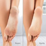 Electric Callus Remover Silkn Vacupedi (5 enheder) #3