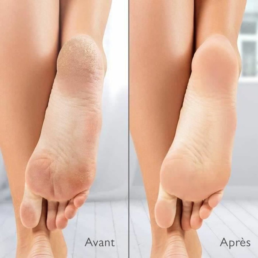 Electric Callus Remover Silkn Vacupedi (5 enheder) #3