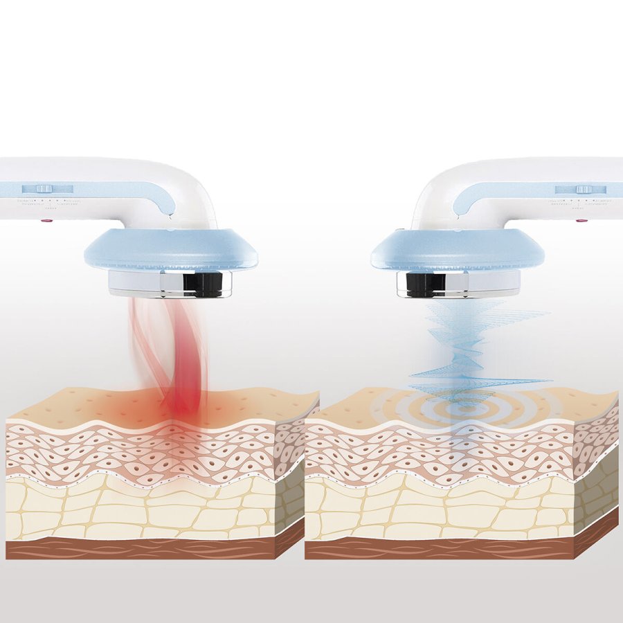 3-i-1 ultralyd kavitation massageapparat til cellulitis med infrardt lys og elektrostimulering CellyMax InnovaGoods #6